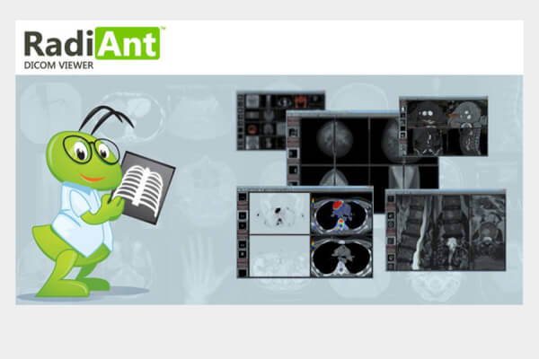 RadiAnt DICOM Viewer 2025.2 (Repack & Portable)